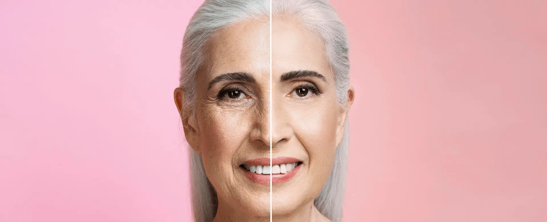 HGH for Anti-Aging - Comparison of Before and After Treatment on Mature Woman's Face